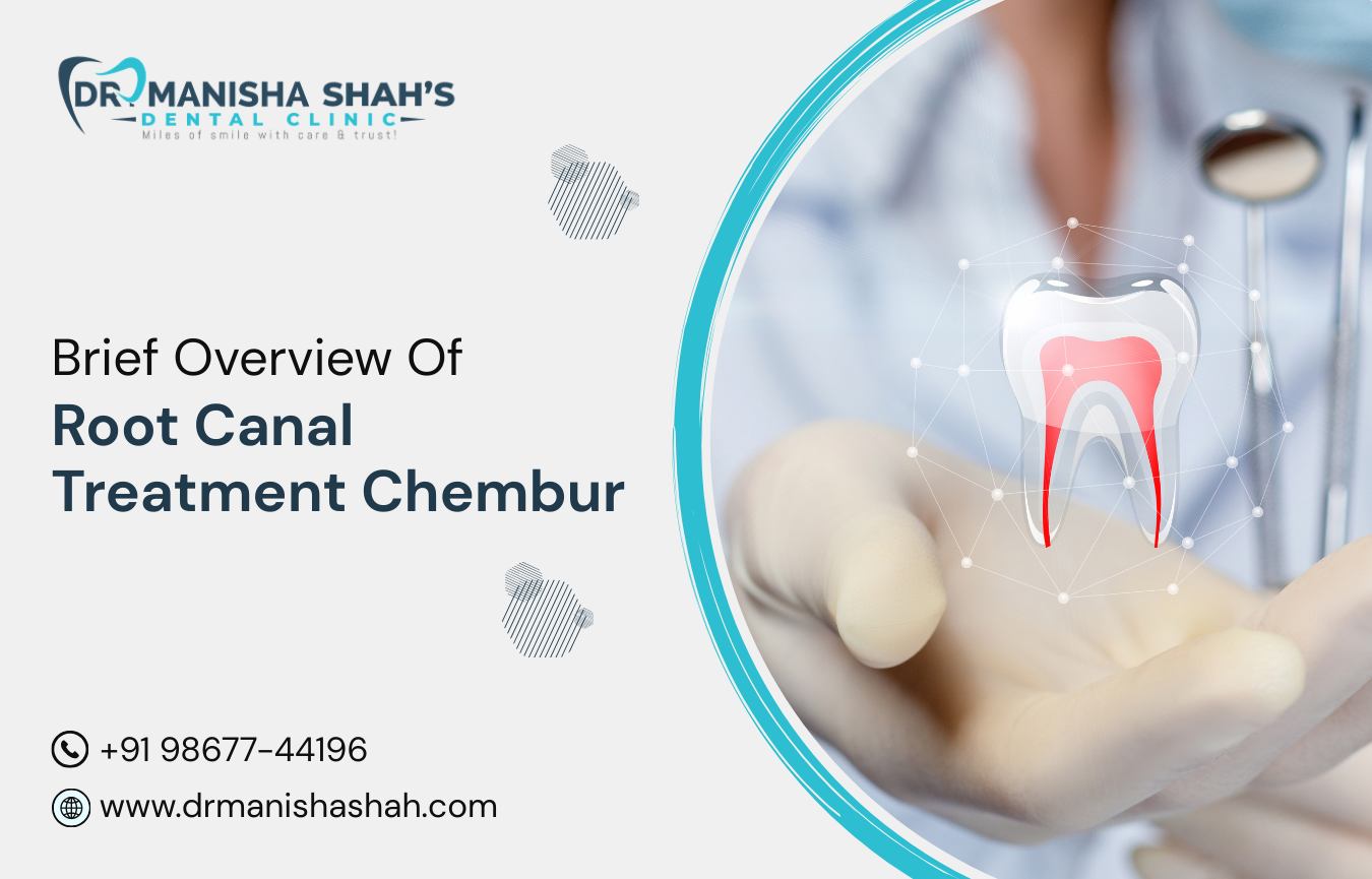 A Brief Overview of Root Canal Treatment in Chembur